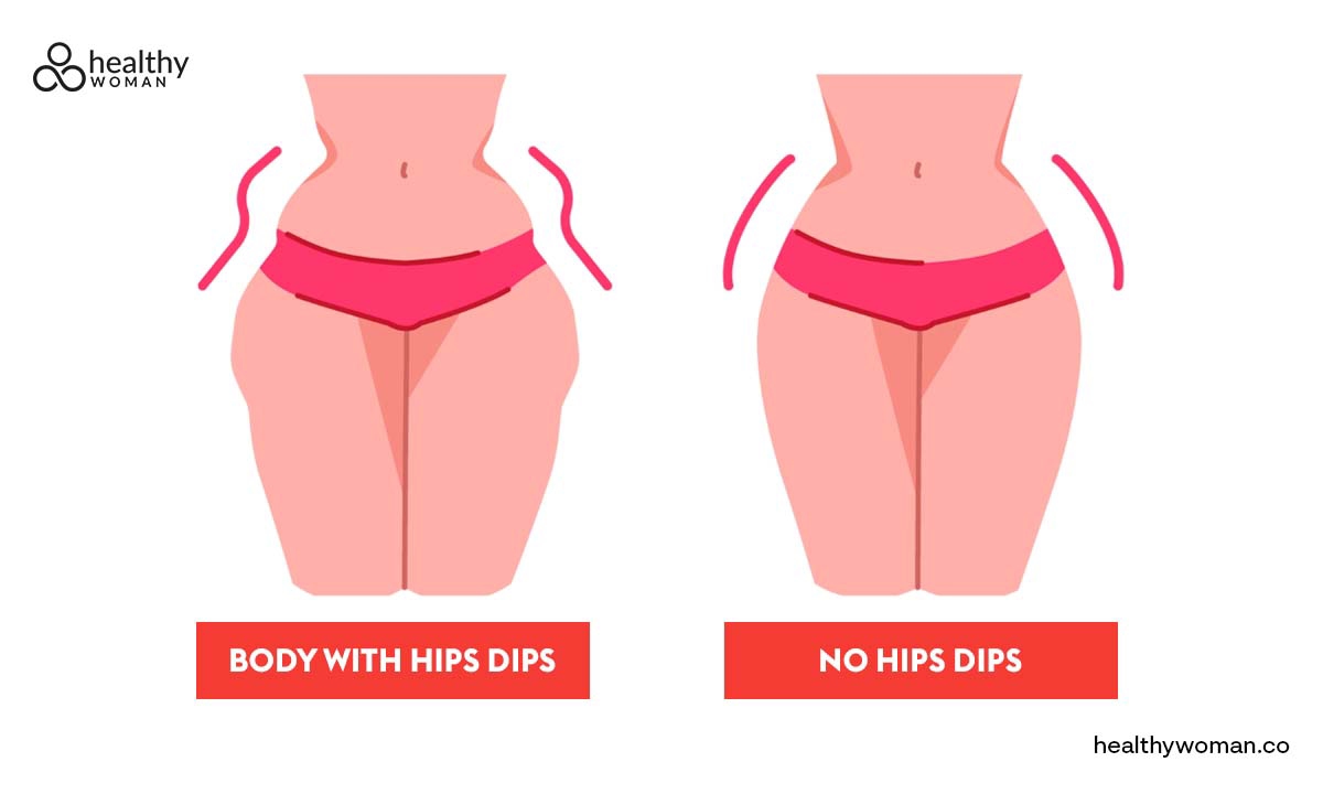 Hip Dips: Why Do You Have Them? How To Get Rid Of It?